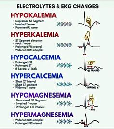 Paramedic Motivation, Er Medicine, Paramedic Tips, Ekg Rhythms, Medical Assistant Student, Paramedic School, Nursing School Motivation, Medical School Life