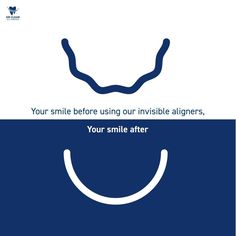 Experience the beauty of your smile and BEAUTIFUL results. Invisible Braces Teeth, Transparent Braces, Christmas Creatives, Dental Post, Straight Smile, Invisible Braces, Clear Aligners