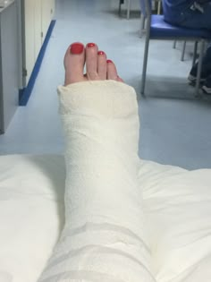 a woman's foot with a cast on top of it in a hospital room