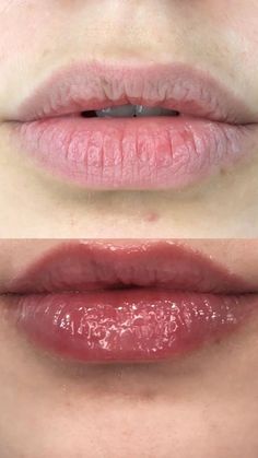 Hydra Gloss Lips, Makeup Removal Tips, Oriflame Beauty Products, Natural Face Skin Care, Permanent Makeup Eyebrows, Baby Lips, Laneige Lip Sleeping Mask, Facial Skin Care Routine, Lip Fillers