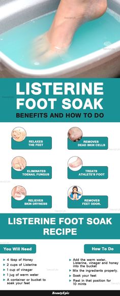 Listerine Foot Soak, Foot Soak Recipe, Makeup Tip, Foot Soak, Skin Dryness, Beauty Clinic, Diy Beauty Hacks, Health And Beauty Tips, Beauty Treatments