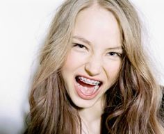 a woman with long hair and braces is making a funny face as she holds her mouth open