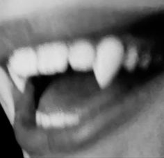 black and white photograph of a woman's mouth with teeth missing from the upper lip