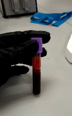 a person in black gloves holding a purple tube with red liquid on it next to a computer keyboard