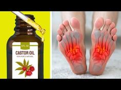 (526) Use Castor Oil Before Bed and See What Happens to Your Body - YouTube Castor Oil For Nails, Castor Oil For Eyes, Slimmer Thighs, Castor Oil Uses, Caster Oil, Avocado Health Benefits, Castor Oil Benefits, Castor Oil Packs, Castor Oil For Hair