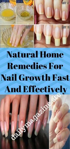 Home Remedies for Nail Growth (Fast & Naturally) Nail Growth Remedies, Nail Growth Faster, Fast Nail, Pedicure Ideas, Spa Ideas, Nail Care Tips, How To Grow Nails, Cold Home Remedies