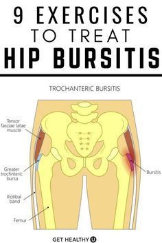 an image of hip bursitiss with the words 9 exercises to treat hip burs