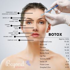 Botox Smile Lines Before After, Where To Get Botox On Face, Lip Flip, Botox Before And After, Botox Lips, Botox Cosmetic