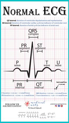 Normal ECG cheatsheet explains the mechanism of PQRST , helps calculate the durations of PQRST in seconds and in small boxes counts (blocks). Simplified version for easy reading. Normal Ecg, Cardiac Cycle, Pr Interval, Basic Anatomy And Physiology, Medical Videos, Human Body Systems, Medical Art, Study Tools