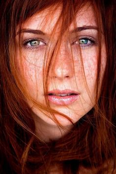 Red Freckles