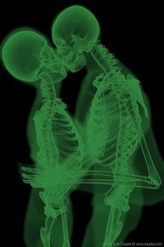 two skeletons sitting next to each other with their arms around one another, looking at the same person's head