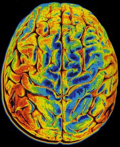 an image of a human brain with different colors and areas in the middle one is blue, yellow, and orange