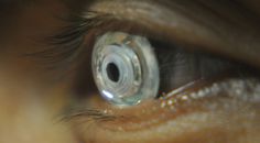 Engineers Develop a Telescopic Contact Lens | In an effort to help improve the vision of patients suffering from eye disease, engineers from the Jacobs School of Engineering at UC San Diego have developed a telescopic contact lens that can switch between normal and magnified vision. [Eyes: http://futuristicnews.com/tag/eye/ Future Medicine: http://futuristicnews.com/tag/future-medicne/] Eye Sight Improvement, Contact Lens, Electrical Engineering, Black Mirror