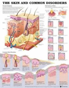 the skin and common disorders poster