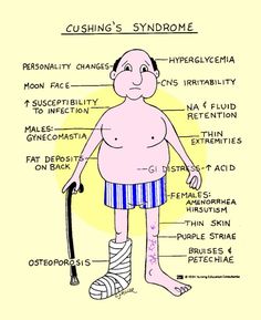 an old man with crutches and bandages on his feet is labeled in the diagram