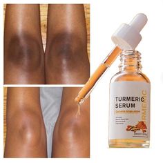 Turmeric Serum For Flawless Face Beauty | Inspire Uplift Face Whitening Serum, Turmeric Serum, Dark Spot Corrector Serum, Dark Spots On Skin, Dark Spot Corrector, Lemon Oil, Skin Glow, Skin Serum