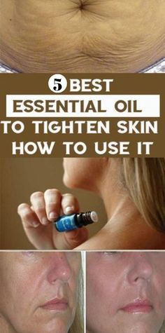 Tighten Skin, Best Essential Oils, Loose Skin, Essential Oil Uses, Essential Oil Recipes, Young Living Essential Oils