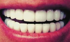 a close up of a person's mouth with white teeth