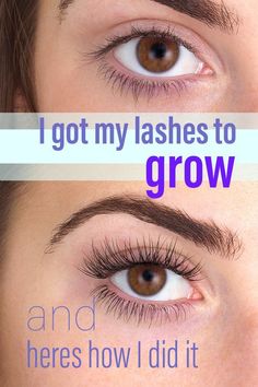 . Eyelashes How To Apply, City Lips, Doterra Oil, Black Heads, Great Lash, Remove Hair, Lash Growth, Lash Boost