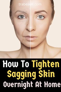 There are many reasons our skin becomes saggy and loses its elasticity. The symptoms of saggy skin are dryness, sagging, wrinkles, fine lines, and dullness. So, let’s check out the ways in which we can tighten our skin and make it look young and tight- Saggy Face, Wrinkles Remedies Face, Face Pack, Skin Care Wrinkles, Glow Skin, Saggy Skin, Face Wrinkles, Wrinkled Skin, Skin Remedies