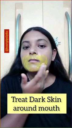 How to remove pigmentation,  dark spots around mouth 

Ingredients 
 • gram flour
 • wild Turmeric powder
 • potato juice

What Causes Dark Skin Around the Mouth?

The darkening of the skin around the mouth can occur due to several reasons, and it is crucial to understand the underlying causes before seeking appropriate treatment. Here are some common factors that contribute to this condition:

Hyperpigmentation: Hyperpigmentation is a condition characterized by the excessive production of melanin, the pigment responsible for giving color to our skin. When there is an overproduction of melanin around the mouth area, it can lead to darkening of the skin.

Sun Exposure: Prolonged sun exposure can stimulate the production of melanin, resulting in dark spots or patches on the skin. The deli Dark Spots Around Mouth, Remedies For Hyperpigmentation, Dark Skin Around Mouth, Darkness Around Mouth, Beginner Skin Care Routine, Potato Juice, Face Skin Care Routine, Dark Spots On Face, Clear Healthy Skin