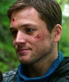 a close up of a person with blood on his face