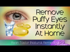 How To Remove Puffy Eyes Instantly (Natural Remedies) - YouTube Puffy Eye Cream, Eyes Bags, Facial Diy, Face Wrinkles Remedies, Puffy Eyes Remedy, Wrinkles Remedies, Dark Circle Remedies, Diy Eye Cream, Swollen Eyes