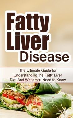 Fatty Liver Disease: The Ultimate Guide for Understanding the Fatty Liver Diet And What You Need to Know (FLD, Alcohol, NAFLD, Metabolic Syndrome, Steatosis, Alcoholic Liver Disease, Obesity) by Wade Migan, http://www.amazon.com/dp/B00IBJ9PDA/ref=cm_sw_r_pi_dp_QOnatb1J97AN2 Liver Flush, Liver Detox Diet, Healthy Detox Cleanse, Liver Care, Liver Recipes