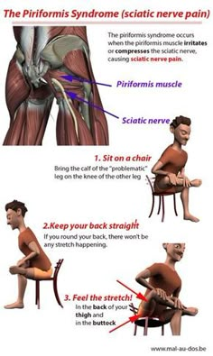 The piriformis syndrome is a condition that occurs when the piriformis muscle irritates or compresses the sciatic nerve causing sciatic nerver pain. Here's how to stretch the piriformis muscle (including video) to get sciatic nerve pain relief. Human Body Diagram, Sciatic Nerve Pain Relief, Sciatica Stretches, Piriformis Muscle, Piriformis Stretch, Body Diagram, Sciatica Exercises, Piriformis Syndrome