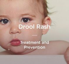 Drool rash is a common irritation found around the mouth, chin, and cheeks of babies and toddlers. Here's how to prevent and cure it. Baby Neck Rash, Teething Rash, Baby Reference, Toddler Rash, Rash On Neck, Baby Cheeks, Things To Keep In Mind