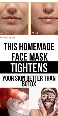 Natural Facial Mask, Homemade Face Mask, Natural Facial, Homemade Face Masks, Skin Remedies, Homemade Face, Unwanted Hair Removal