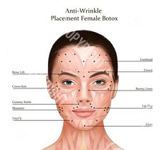 Botox Lip Flip, Injection Sites, Botox Injection, Lip Flip, Botox Filler, Muscles Of The Face, Aesthetic Dermatology