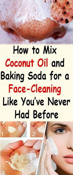 Coconut Oil And Baking Soda, Baking Soda Face, Coconut Oil For Acne, Face Cleaning, Coconut Oil For Skin, How To Mix, Skin Remedies, Diy Beauty Hacks