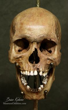 a human skull with teeth and bones attached to it