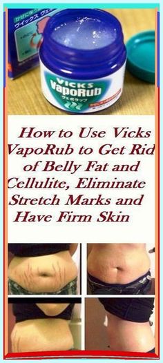 HOW TO USE VICKS VAPORUB FOR STRETCH MARKS, TO GET RID OF BELLY FAT AND GET FIRM AND SMOOTH SKIN Congested Nose, Vapo Rub, Vaporub Uses, Vicks Vapor Rub, Vicks Vapor, Vicks Vaporub Uses, Uses For Vicks, Vapor Rub, Vicks Vaporub