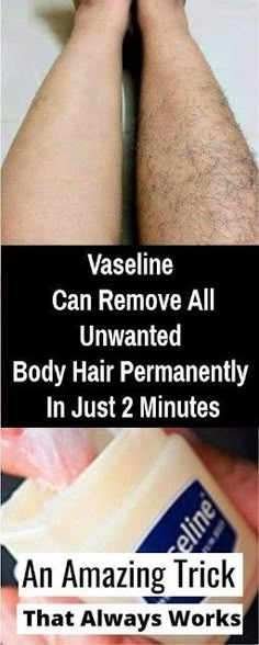 Brazilian Hair Removal, Permanent Hair Removal Cream, Upper Lip Hair Removal, Permanent Facial Hair Removal, Leg Hair Removal, Electrolysis Hair Removal, Lip Hair Removal, Upper Lip Hair, Unwanted Hair Permanently