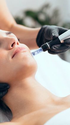 Skin Needling, Cosmetic Dermatology, Reduce Pores, Skin Therapy, Dermal Fillers, Improve Skin Texture, Hair Restoration, Med Spa, Skin Issues