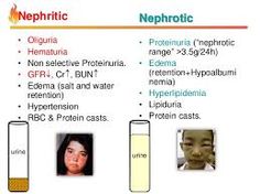 Afbeeldingsresultaat voor nephrotic syndrome nephritic Medical School Interview Questions, Nephritic Syndrome, Pediatric Nursing Quotes, Medical School Interview, Physician Assistant School, Doctor Of Nursing Practice, Nephrotic Syndrome, Medical Mnemonics