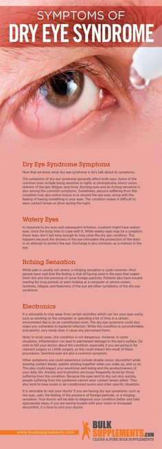 With the increase in smartphone use, dry eye syndrome is becoming an increasingly common condition. Luckily, it is easily treatable. Dry Eyes Causes, Blurry Vision, Watery Eyes, Eye Exercises, Eye Sight Improvement, Cold Sores Remedies, Natural Sleep Remedies