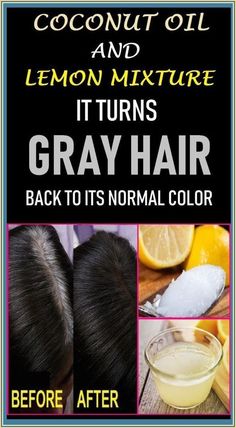 Reverse Gray Hair, Prevent Grey Hair, Regrow Hair, Health Journal, Hair Starting, Gray Hair, Grey Hair