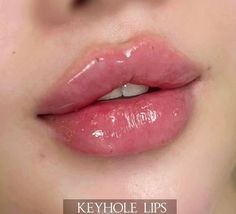 Pretty Full Lips, Lana Del Rey Lip Filler, Cindy Kimberly Lips, Lip Shapes Filler, Doll Lips Filler, Full Lips Aesthetic, Perfect Lips Natural, Lips With Filler, Lip Filler Styles