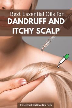 Discover how to use essential oils to naturally cure dandruff and soothe an itchy scalp. Say goodbye to flakes and discomfort with these effective remedies. #DandruffCure #ItchyScalpRelief #EssentialOils #NaturalHairCare #HealthyScalp #EssentialOilsBlends #NaturalHealing #HomeRemedies #EssentialOilsUses Essential Oils For Dandruff, Essential Oils For Congestion, Essential Oils For Cough, Oils For Sore Throat, Oils For Dandruff, Essential Oils For Kids