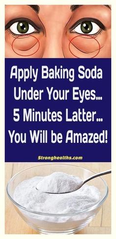 Baking Soda Under Eyes, Puffy Eyes Remedy, Wrinkles Remedies, Wrinkles Remedies Face, Skin Care Wrinkles, Baking Soda Shampoo, Face Wrinkles, Skin Care Remedies, Wrinkle Cream