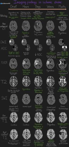 an image of the brain and its functions