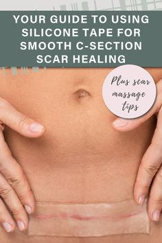 CARING FOR YOUR C-SECTION SCAR: TIPS AND INSIGHTS FOR A SMOOTH RECOVERY | UNDEFINING MOTHERHOOD | Welcome to the ultimate C-Section scar recovery guide for new moms! Explore the powerful benefits of scar massage and discover the effectiveness of silicone tape in promoting optimal scar healing. Want to say goodbye to worries about a prominent scar and embrace your post-C-Section journey with confidence? Click here! Scar Massage, C Section Scar, Scar Healing, Oils For Scars, C Section Scars, Scar Reduction