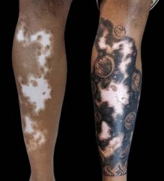 two people with black and white tattoos on their legs, one is covered in brown spots