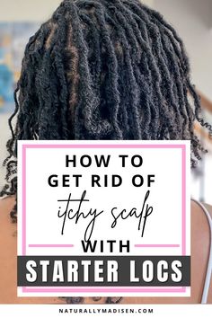 Dry Scalp With Locs, Starter Loc Care, Starter Loc Products, Tips For Starter Locs, Best Loc Products, How To Take Care Of Starter Locs, Starter Locs Care Tips, Starter Loc Maintenance Tips, Coil Starter Locs Journey