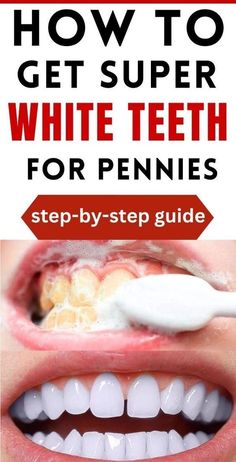 How To Get Super White Teeth For Pennies ! Step-by-Step Guide ! Whiten Teeth Naturally, Whiten Your Teeth At Home, Tooth Decay Remedies, Teeth Whitening Homemade, Tooth Whitening, Teeth Whitening Remedies, Teeth Whitening Diy, Whiten Your Teeth, Whitening Products