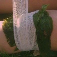 a woman's arm wrapped in white gauze with green leaves on the side