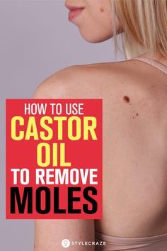 Moles On Face, Narrow Laundry, Remove Moles, Castor Oil Benefits, Skin Moles, Skin Growths, Mole Removal, Beauty Tips For Skin, Oil Benefits